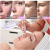 Portable Exfoliation Vacuum Suction Aqua Peel Microdermabrasion Machine Diamond Microdermabrasion Facial Machine