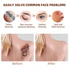 Gentle Max Pro Laser Hair Removal Tattoo Removal Machine Price Picosecond Laser 2 In 1 Hair And Tattoo Remove Diode Laser