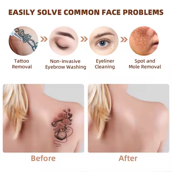Gentle Max Pro Laser Hair Removal Tattoo Removal Machine Price Picosecond Laser 2 In 1 Hair And Tattoo Remove Diode Laser
