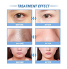 14 In 1 Aqua Hydro Dermabrasion Hydrodermabrasion Facial Machine Hydro Dermabrasion Hydrofacials