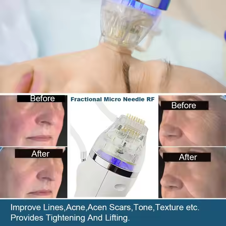 Rf Microneedling Machine Anti-wrinkle Microneedle Rf Fractional Micro Needle Machine Portable Desktop OEM ODM